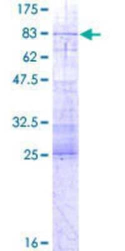 Novus Biologicals Recombinant Human IFRD1 GST (N-Term) Protein 2 &mu;g | Buy Online | Novus Biologicals&trade; | Fisher Scientific