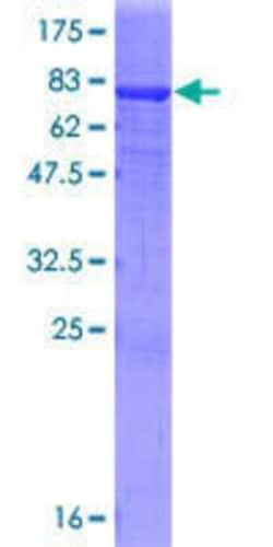 Novus Biologicals Recombinant Human IgA2 GST (N-Term) Protein 25 &mu;g | Buy Online | Novus Biologicals&trade; | Fisher Scientific