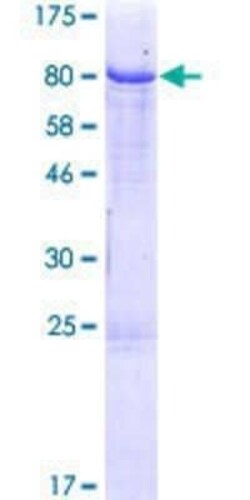 Novus Biologicals Recombinant Human IgM GST (N-Term) Protein 25 &mu;g | Buy Online | Novus Biologicals&trade; | Fisher Scientific