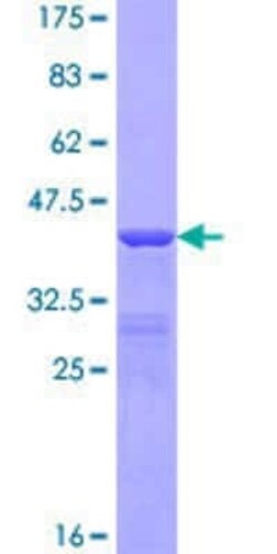 Novus Biologicals Recombinant Human Kappa Light Chain GST (N-Term) Protein 25 &mu;g | Buy Online | Novus Biologicals&trade; | Fisher Scientific