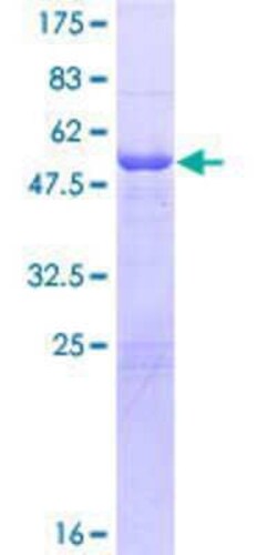 Novus Biologicals Recombinant Human IgL GST (N-Term) Protein 25 &mu;g | Buy Online | Novus Biologicals&trade; | Fisher Scientific