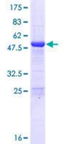 Novus Biologicals Recombinant Human Ig Lambda C Domain/IGLC2 GST (N-Term) Protein 25 &mu;g | Buy Online | Novus Biologicals&trade; | Fisher Scientific