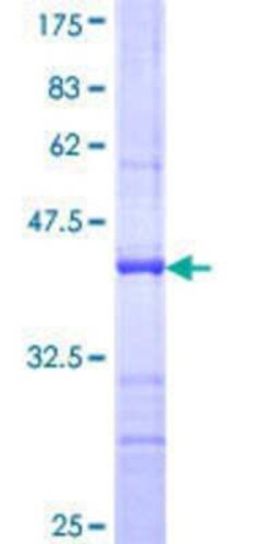Novus Biologicals Recombinant Human ILF2 GST (N-Term) Protein 10 &mu;g | Buy Online | Novus Biologicals&trade; | Fisher Scientific