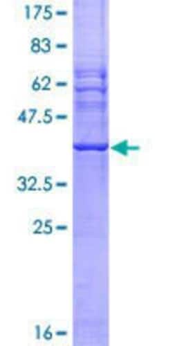 Novus Biologicals Recombinant Human ILK GST (N-Term) Protein 10 &mu;g | Buy Online | Novus Biologicals&trade; | Fisher Scientific
