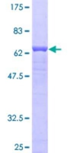 Novus Biologicals Recombinant Human INPP1 GST (N-Term) Protein 10 &mu;g | Buy Online | Novus Biologicals&trade; | Fisher Scientific