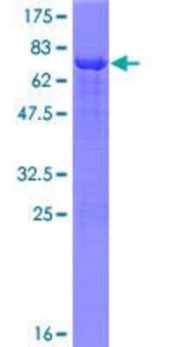 Novus Biologicals Recombinant Human INPP1 GST (N-Term) Protein 25 &mu;g | Buy Online | Novus Biologicals&trade; | Fisher Scientific
