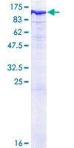 Novus Biologicals Recombinant Human INPP5B GST (N-Term) Protein 25 &mu;g | Buy Online | Novus Biologicals&trade; | Fisher Scientific