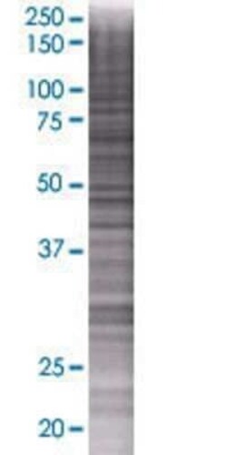 Novus Biologicals INPP5B 293T Cell Transient Overexpression Lysate 0.1 mL | Buy Online | Novus Biologicals&trade; | Fisher Scientific