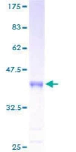 Novus Biologicals Recombinant Human INSL4 GST (N-Term) Protein 25 &mu;g | Buy Online | Novus Biologicals&trade; | Fisher Scientific