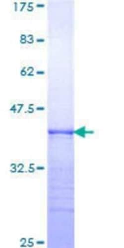 Novus Biologicals Recombinant Human Integrin alpha 6/CD49f GST (N-Term) Protein 25 &mu;g | Buy Online | Novus Biologicals&trade; | Fisher Scientific