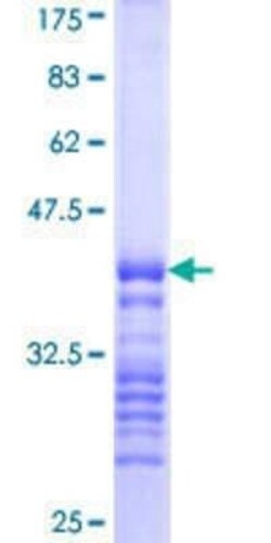 Novus Biologicals Recombinant Human IRAK2 GST (N-Term) Protein 25 &mu;g | Buy Online | Novus Biologicals&trade; | Fisher Scientific