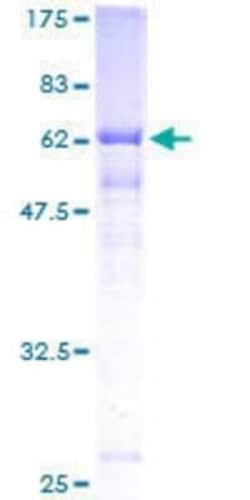 Novus Biologicals Recombinant Human IRP2 GST (N-Term) Protein 10 &mu;g | Buy Online | Novus Biologicals&trade; | Fisher Scientific
