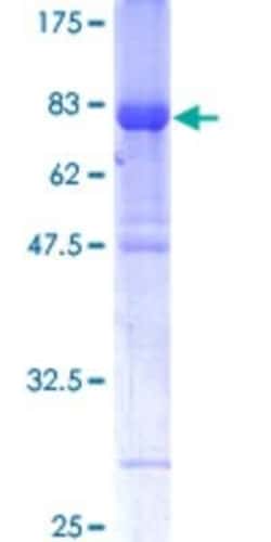Novus Biologicals Recombinant Human IRF6 GST (N-Term) Protein 10 &mu;g | Buy Online | Novus Biologicals&trade; | Fisher Scientific
