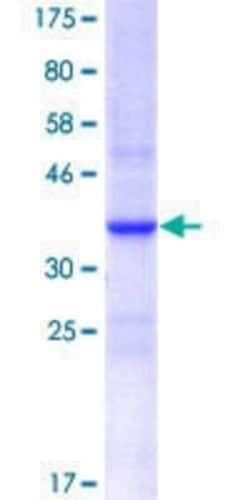 Novus Biologicals Recombinant Human IRF6 GST (N-Term) Protein 25 &mu;g | Buy Online | Novus Biologicals&trade; | Fisher Scientific