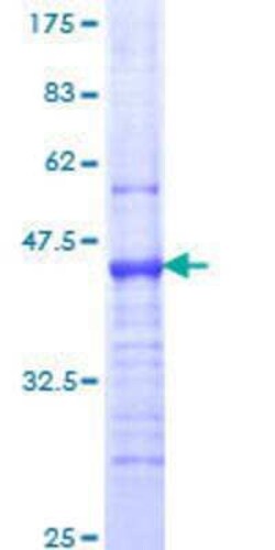 Novus Biologicals Recombinant Human Integrin alpha 1/CD49a GST (N-Term) Protein 25 &mu;g | Buy Online | Novus Biologicals&trade; | Fisher Scientific