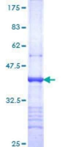 Novus Biologicals Recombinant Human Integrin alpha 9 GST (N-Term) Protein 25 &mu;g | Buy Online | Novus Biologicals&trade; | Fisher Scientific
