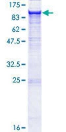 Novus Biologicals Recombinant Human Integrin beta 5 GST (N-Term) Protein 25 &mu;g | Buy Online | Novus Biologicals&trade; | Fisher Scientific