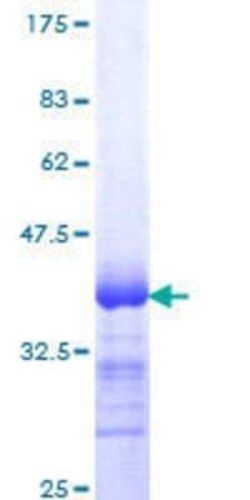 Novus Biologicals Recombinant Human Integrin beta 5 GST (N-Term) Protein 10 &mu;g | Buy Online | Novus Biologicals&trade; | Fisher Scientific