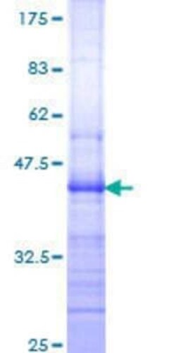 Novus Biologicals Recombinant Human Integrin beta 7 GST (N-Term) Protein 25 &mu;g | Buy Online | Novus Biologicals&trade; | Fisher Scientific