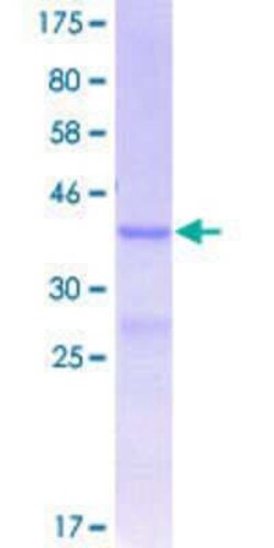 Novus Biologicals Recombinant Human Integrin beta 8 GST (N-Term) Protein 25 &mu;g | Buy Online | Novus Biologicals&trade; | Fisher Scientific