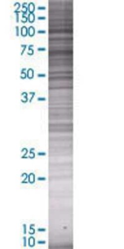 Novus Biologicals&trade;&nbsp;Integrin beta 8 293T Cell Transient Overexpression Lysate