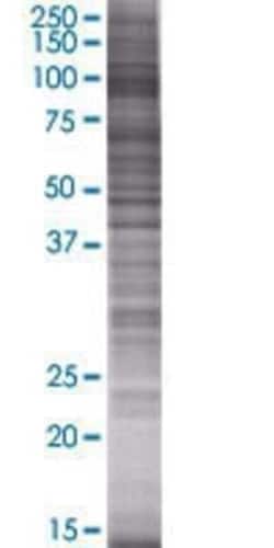 Novus Biologicals ITIH1 293T Cell Transient Overexpression Lysate 0.1 mL | Buy Online | Novus Biologicals&trade; | Fisher Scientific