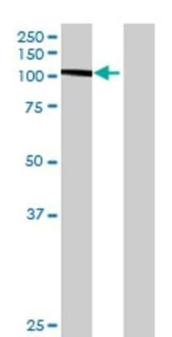 Novus Biologicals ITIH1 293T Cell Transient Overexpression Lysate 0.1 mL | Buy Online | Novus Biologicals&trade; | Fisher Scientific