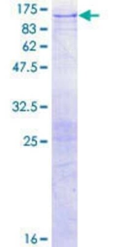 Novus Biologicals Recombinant Human ITPKB GST (N-Term) Protein 2 &mu;g | Buy Online | Novus Biologicals&trade; | Fisher Scientific