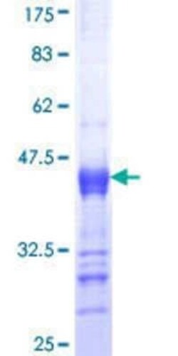 Novus Biologicals Recombinant Human ITPKB GST (N-Term) Protein 25 &mu;g | Buy Online | Novus Biologicals&trade; | Fisher Scientific