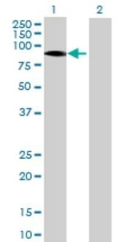 Novus Biologicals ITPKB 293T Cell Transient Overexpression Lysate 0.1 mL | Buy Online | Novus Biologicals&trade; | Fisher Scientific