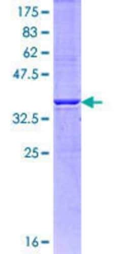 Novus Biologicals Recombinant Human IP3R1 GST (N-Term) Protein 25 &mu;g | Buy Online | Novus Biologicals&trade; | Fisher Scientific