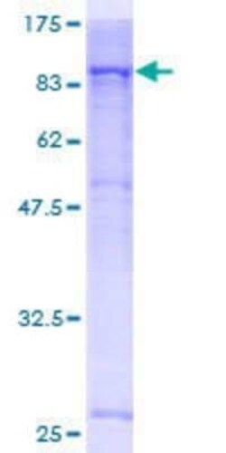 Novus Biologicals Recombinant Human Jak3 GST (N-Term) Protein 2 &mu;g | Buy Online | Novus Biologicals&trade; | Fisher Scientific