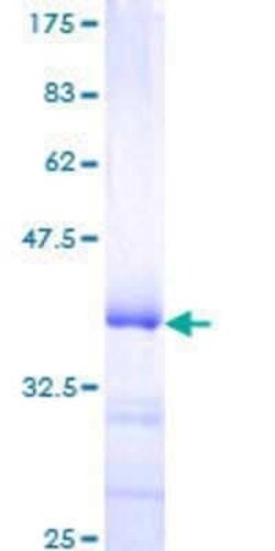 Novus Biologicals Recombinant Human JunB/AP-1 GST (N-Term) Protein 10 &mu;g | Buy Online | Novus Biologicals&trade; | Fisher Scientific