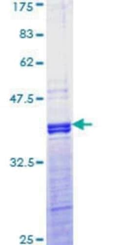 Novus Biologicals Recombinant Human JunD GST (N-Term) Protein 2 &mu;g | Buy Online | Novus Biologicals&trade; | Fisher Scientific