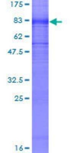 Novus Biologicals Recombinant Human Kv1.1 GST (N-Term) Protein 10 &mu;g | Buy Online | Novus Biologicals&trade; | Fisher Scientific