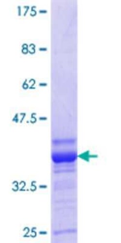 Novus Biologicals Recombinant Human Kv1.1 GST (N-Term) Protein 25 &mu;g | Buy Online | Novus Biologicals&trade; | Fisher Scientific