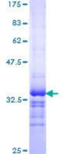 Novus Biologicals Recombinant Human KCNE1 GST (N-Term) Protein 10 &mu;g | Buy Online | Novus Biologicals&trade; | Fisher Scientific