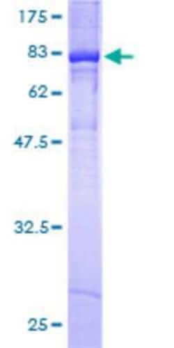 Novus Biologicals Recombinant Human Kv5.1 GST (N-Term) Protein 10 &mu;g | Buy Online | Novus Biologicals&trade; | Fisher Scientific