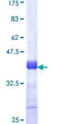 Novus Biologicals Recombinant Human KCNH1 GST (N-Term) Protein 10 &mu;g | Buy Online | Novus Biologicals&trade; | Fisher Scientific