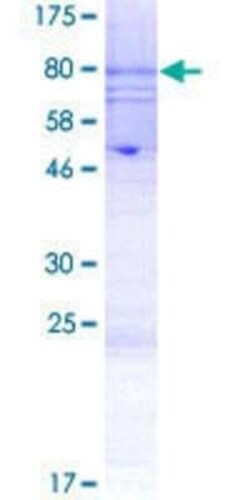 Novus Biologicals Recombinant Human KIR2.3 GST (N-Term) Protein 2 &mu;g | Buy Online | Novus Biologicals&trade; | Fisher Scientific