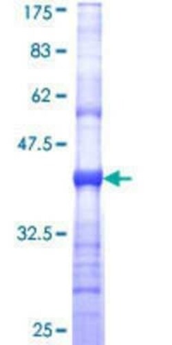 Novus Biologicals Recombinant Human KCNJ10 GST (N-Term) Protein 10 &mu;g | Buy Online | Novus Biologicals&trade; | Fisher Scientific