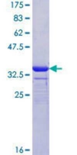 Novus Biologicals Recombinant Human Kir6.2 GST (N-Term) Protein 10 &mu;g | Buy Online | Novus Biologicals&trade; | Fisher Scientific