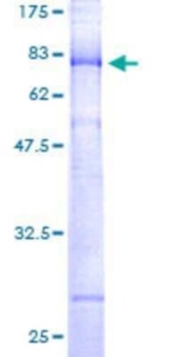 Novus Biologicals Recombinant Human Kir2.2 GST (N-Term) Protein 25 &mu;g | Buy Online | Novus Biologicals&trade; | Fisher Scientific