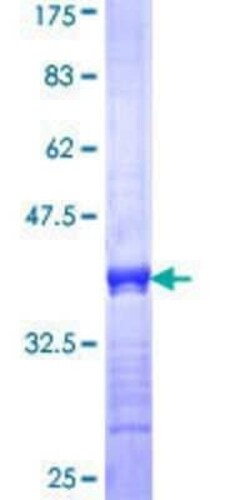 Novus Biologicals Recombinant Human KIR5.1 GST (N-Term) Protein 10 &mu;g | Buy Online | Novus Biologicals&trade; | Fisher Scientific