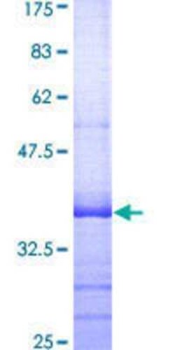 Novus Biologicals Recombinant Human Maxi Potassium channel beta GST (N-Term) Protein 10 &mu;g | Buy Online | Novus Biologicals&trade; | Fisher Scientific