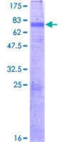 Novus Biologicals Recombinant Human KCNN3 GST (N-Term) Protein 10 &mu;g | Buy Online | Novus Biologicals&trade; | Fisher Scientific