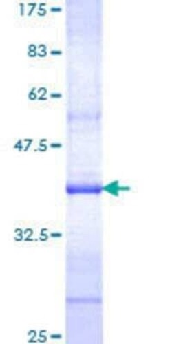 Novus Biologicals Recombinant Human KCNN3 GST (N-Term) Protein 2 &mu;g | Buy Online | Novus Biologicals&trade; | Fisher Scientific