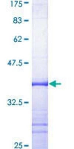 Novus Biologicals Recombinant Human KCNN4 GST (N-Term) Protein 2 &mu;g | Buy Online | Novus Biologicals&trade; | Fisher Scientific