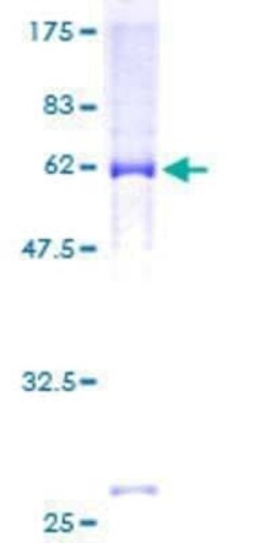 Novus Biologicals Recombinant Human Kv7.2 GST (N-Term) Protein 2 &mu;g | Buy Online | Novus Biologicals&trade; | Fisher Scientific
