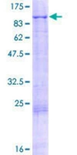 Novus Biologicals Recombinant Human Kell GST (N-Term) Protein 2 &mu;g | Buy Online | Novus Biologicals&trade; | Fisher Scientific